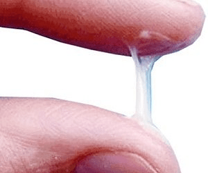 ¿Cómo se ve normalmente la secreción de un hombre